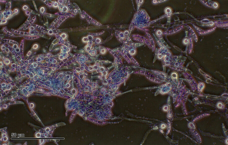 Vista microscópica del Pythium