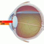 Rayos UV y el ojo