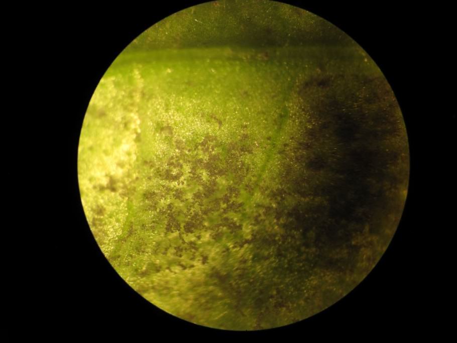 Tejido de albahaca afectado por Mildiu, vista microscópica