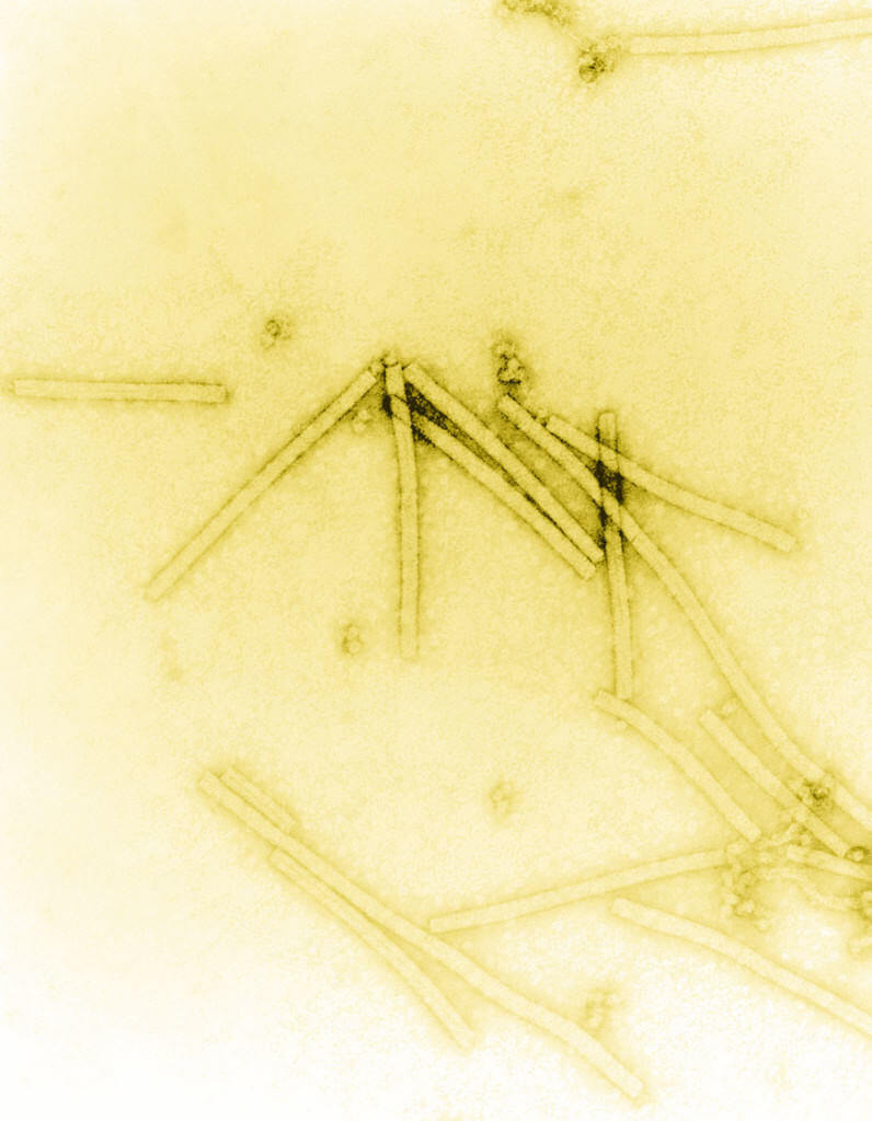 Virus del mosaico del tabaco VMT 