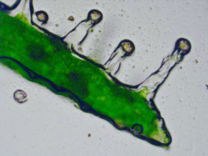 Tricomas glandulares vistos con microscopio