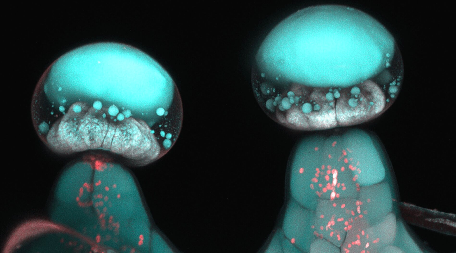 Los tricomas del cannabis bajo el microscopio electrónico