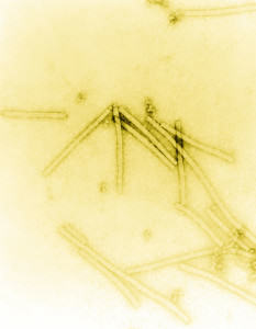 Virus del mosaic del tabac VMT (Font: Wikipedia)