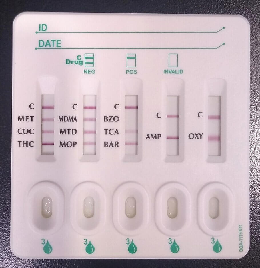 Bei diesem Urintest auf verschiedene Substanzen scheint es, dass wir einen positiven Fall für Benzodiazepine haben.