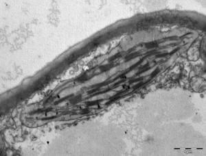 Chloroplast