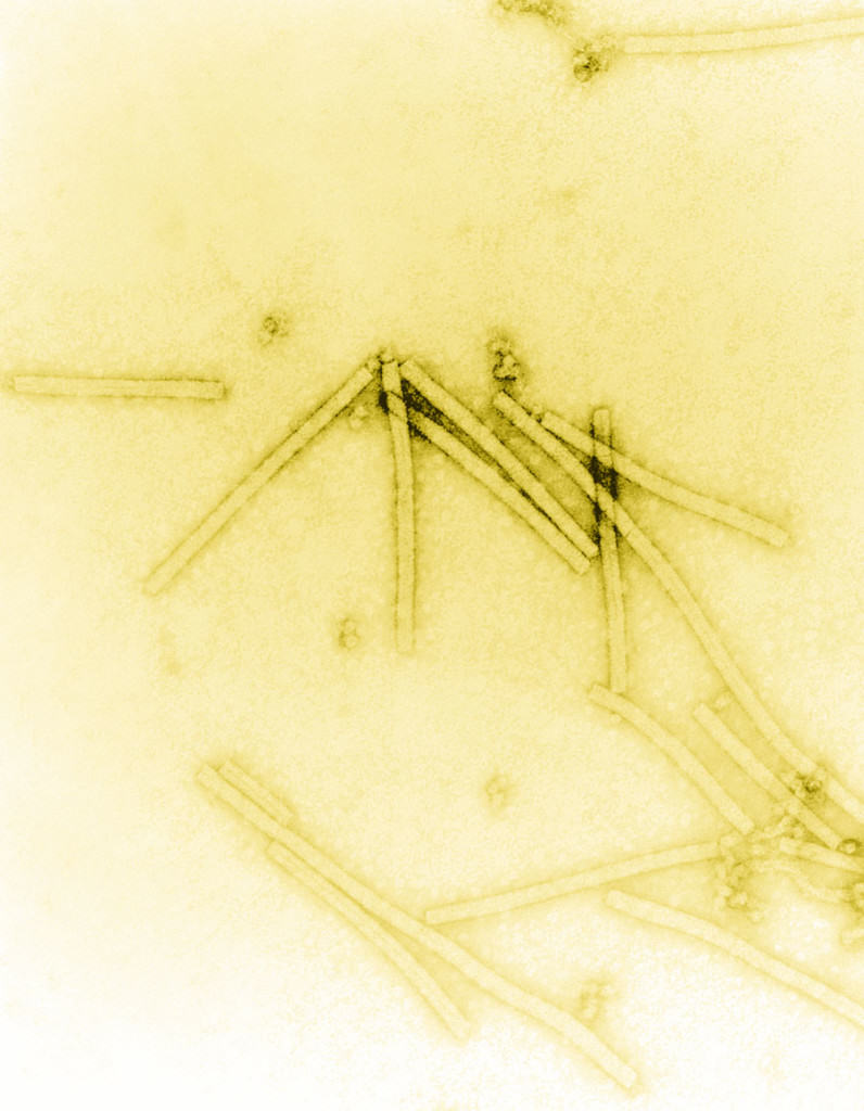 Tobacco mosaic virus