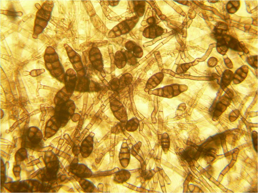 Alternaria alternata spores