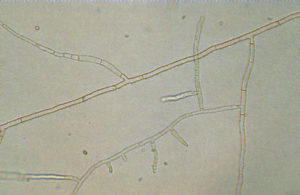 Rhizoctonia seen under microscope