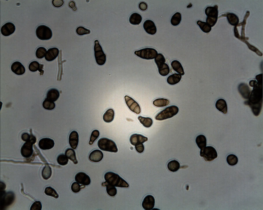 Microscopic View of Alternaria Alternata 