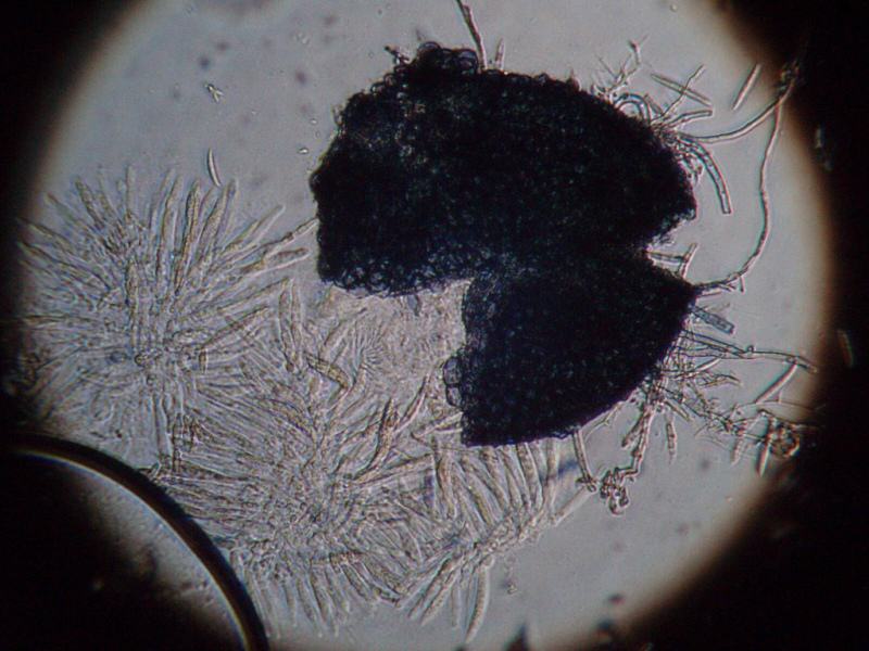 Microscope slide showing a squashed perithecia of Fusarium graminearum (teleomorph Gibberella zeae). The ascospores that have been produced have burst out to the side. This is the pathogen that causes Fusarium head blight (FHB) of wheat and other cereals. Photo credit: CIMMYT.