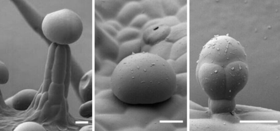 Stalked, sessile and bulbous trichomes; (Livingston et al. 2020, Fig. 1.) Each scale bar measures 20 µm