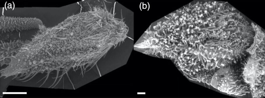 The sessile trichomes develop a stem and grow as the plant matures.