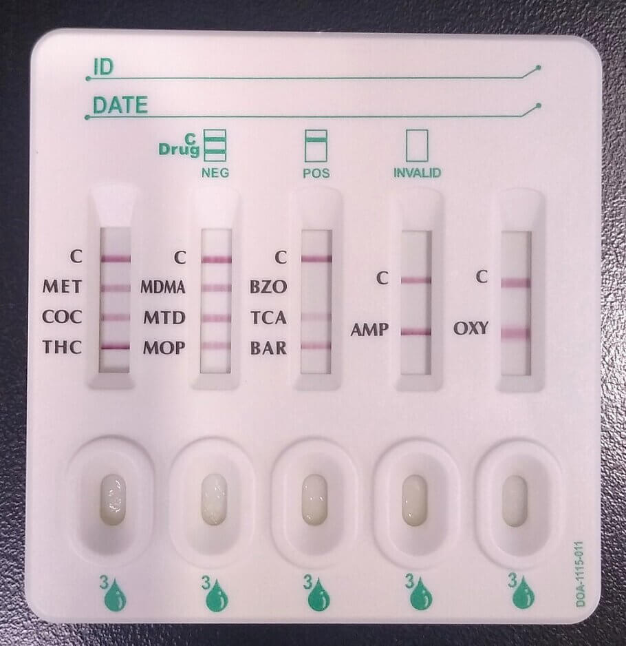 In this urine test for various substances it seems that we have a positive case for benzodiazepines