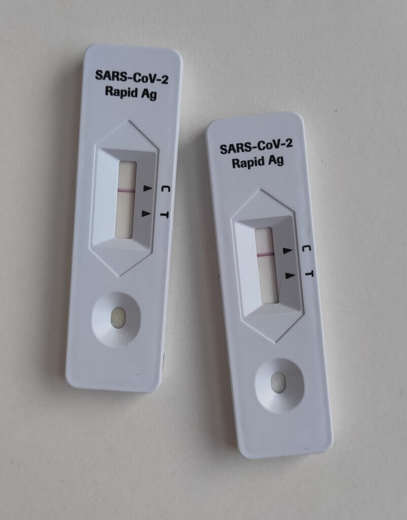 Saliva tests are not only used to detect drugs (Photo: Steve Nomax)