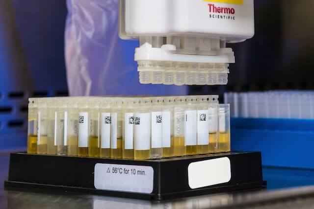 Urine tests can tell a lot about our habits, including cannabis use (Image: CDC)