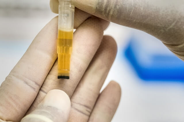 A small amount of urine is sufficient to detect a wide range of drugs