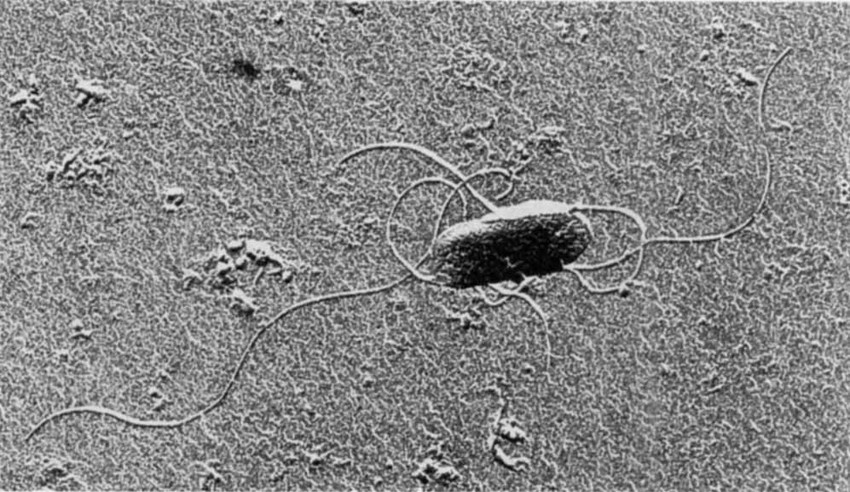 Erwinia alni seen through an electron microscope (Image: Roberta Pastorelli)