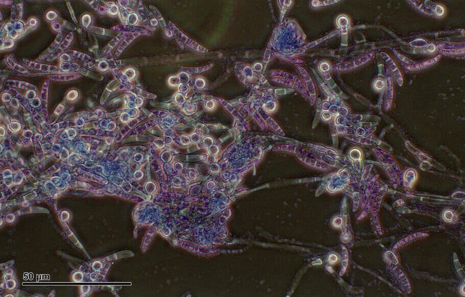 Vue microscopique du Pythium