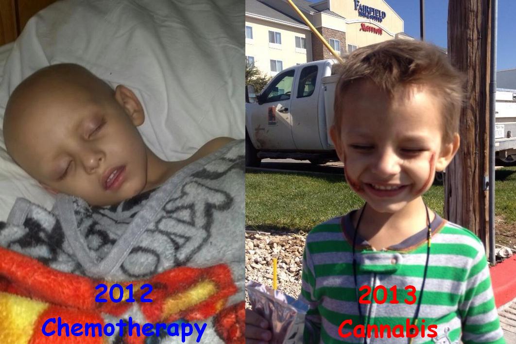 Le petit Landon Riddle, 3 ans, atteint de leucémie, se soigne maintenant avec le cannabis