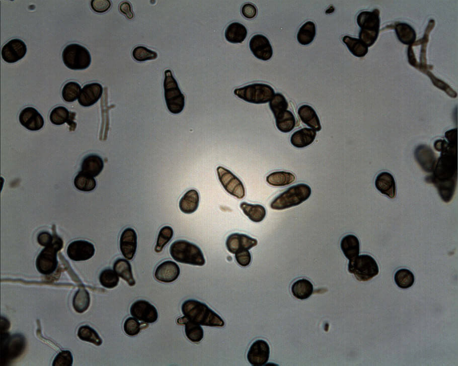 Vue microscopique de l’Alternaria Alternata. 