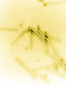 Virus de la mosaïque du tabac VMT (Source : Wikipedia)