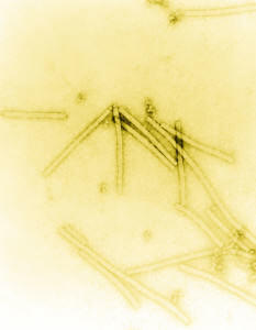 Virus de la mosaïque du tabac VMT (Source : Wikipedia)