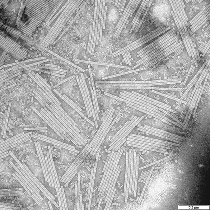 Virus de la mosaïque du tabac.