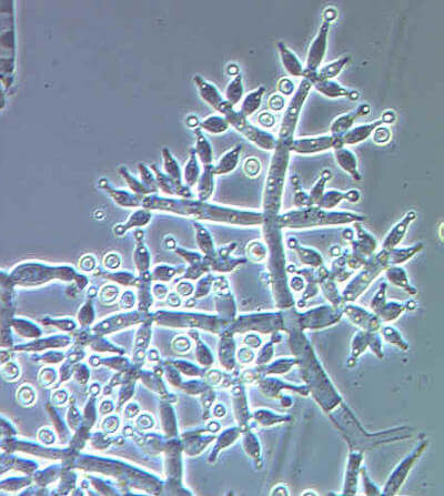 Le Trichoderma Harzianum est très utile pour les plantes. 