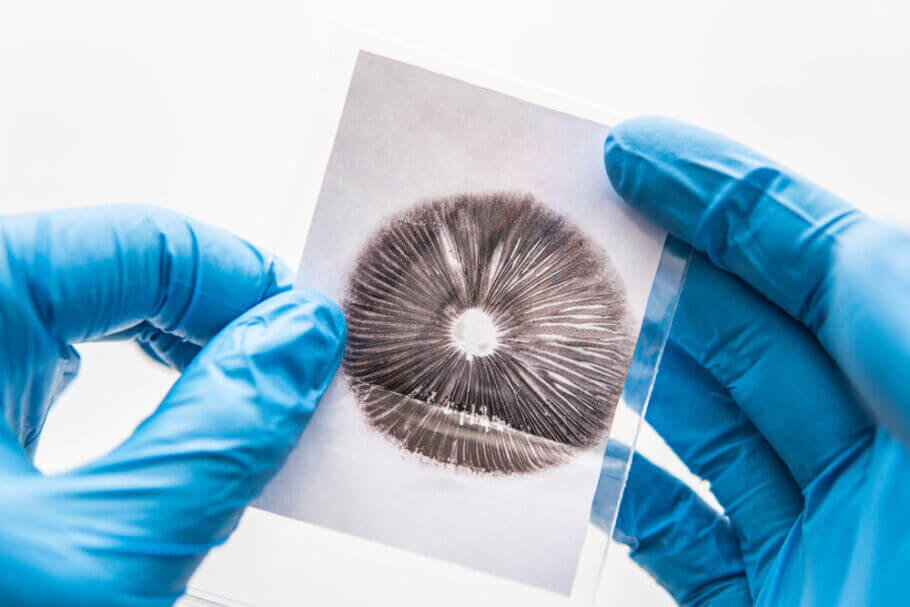 Empreintes et seringues de spores de champignons hallucinogènes